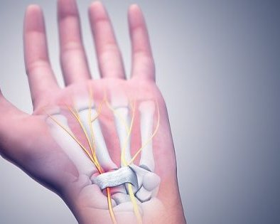 Откуда берётся туннельный синдром и как его лечить
